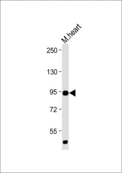 Invitrogen TLR2 Polyclonal Antibody 400 &mu;L | Buy Online | Invitrogen&trade; | Fisher Scientific