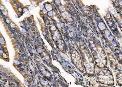 Invitrogen SSH1 Polyclonal Antibody 100 &mu;L; Unconjugated:Antibodies,