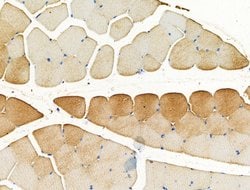 SLIRP Polyclonal Antibody:Antibodies, Polyclonal