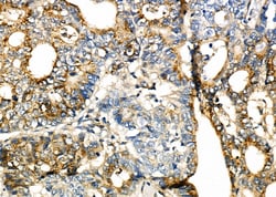 Invitrogen SLIT2 Polyclonal Antibody 100 &mu;L; Unconjugated:Antibodies,