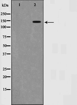 Invitrogen SMC1 Polyclonal Antibody 100 &mu;L; Unconjugated:Antibodies,