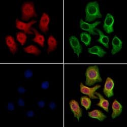 Invitrogen SMC1 Polyclonal Antibody 100 &mu;L; Unconjugated:Antibodies,