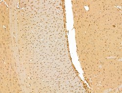 Invitrogen SMC2 Polyclonal Antibody 100 μL; Unconjugated:Antibodies,