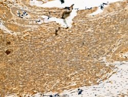 Invitrogen SMC2 Polyclonal Antibody 100 μL; Unconjugated:Antibodies,