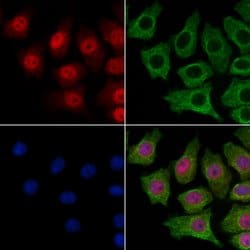 SMC5 Polyclonal Antibody:Antibodies, Polyclonal