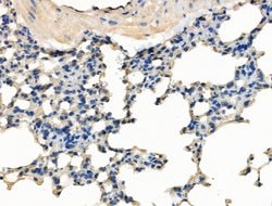 Invitrogen SMCHD1 Polyclonal Antibody 100 &mu;L; Unconjugated:Antibodies,