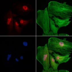 Invitrogen SMG1 Polyclonal Antibody 100 μL; Unconjugated:Antibodies,