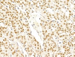 Invitrogen SMG1 Polyclonal Antibody 100 μL; Unconjugated:Antibodies,
