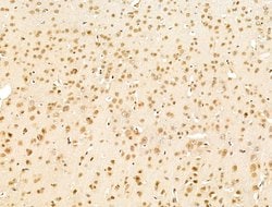 Invitrogen SMG1 Polyclonal Antibody 100 μL; Unconjugated:Antibodies,