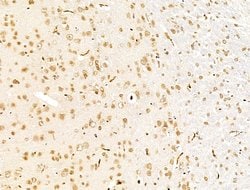 Invitrogen SMG1 Polyclonal Antibody 100 μL; Unconjugated:Antibodies,