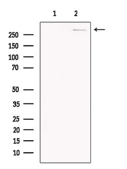 Invitrogen SMG1 Polyclonal Antibody 100 μL; Unconjugated:Antibodies,