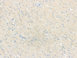 Invitrogen Smoothelin Polyclonal Antibody 100 &mu;L; Unconjugated:Antibodies,