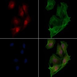 Invitrogen SMYD3 Polyclonal Antibody 100 &mu;L; Unconjugated:Antibodies,