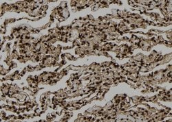 Invitrogen SMYD3 Polyclonal Antibody 100 &mu;L; Unconjugated:Antibodies,