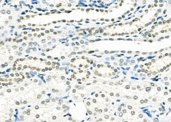 Invitrogen SMYD3 Polyclonal Antibody 100 &mu;L; Unconjugated:Antibodies,