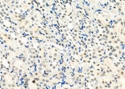 Invitrogen SMYD3 Polyclonal Antibody 100 &mu;L; Unconjugated:Antibodies,