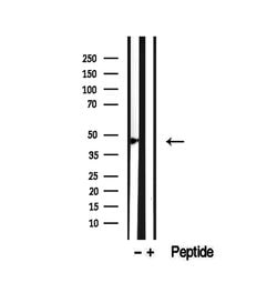 Invitrogen SMYD3 Polyclonal Antibody 100 &mu;L; Unconjugated:Antibodies,
