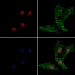Invitrogen SNAIL Polyclonal Antibody 100 &mu;L; Unconjugated:Antibodies,