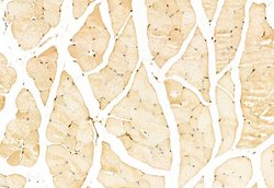 Invitrogen SNAIL Polyclonal Antibody 100 &mu;L; Unconjugated:Antibodies,