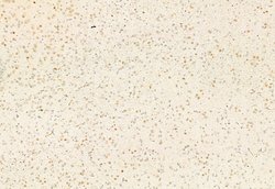 Invitrogen SNAIL Polyclonal Antibody 100 &mu;L; Unconjugated:Antibodies,