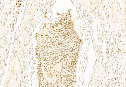 Invitrogen SNAIL Polyclonal Antibody 100 &mu;L; Unconjugated:Antibodies,