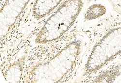 Invitrogen SNAIL Polyclonal Antibody 100 &mu;L; Unconjugated:Antibodies,