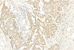 Invitrogen SNAIL Polyclonal Antibody 100 &mu;L; Unconjugated:Antibodies,
