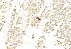 Invitrogen SNAIL Polyclonal Antibody 100 &mu;L; Unconjugated:Antibodies,