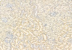 Invitrogen SNAIL Polyclonal Antibody 100 &mu;L; Unconjugated:Antibodies,
