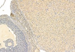 Invitrogen SNAIL Polyclonal Antibody 100 &mu;L; Unconjugated:Antibodies,