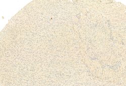 Invitrogen SNAIL Polyclonal Antibody 100 &mu;L; Unconjugated:Antibodies,