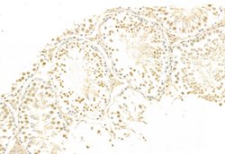 Invitrogen SNAIL Polyclonal Antibody 100 &mu;L; Unconjugated:Antibodies,