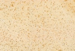 Invitrogen SNAIL Polyclonal Antibody 100 &mu;L; Unconjugated:Antibodies,