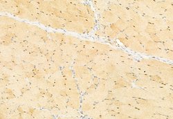 Invitrogen SNAIL Polyclonal Antibody 100 &mu;L; Unconjugated:Antibodies,