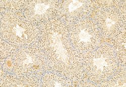 Invitrogen SNAIL Polyclonal Antibody 100 &mu;L; Unconjugated:Antibodies,