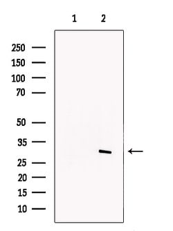 Invitrogen SNAIL Polyclonal Antibody 100 &mu;L; Unconjugated:Antibodies,