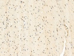 Invitrogen SNRNP200 Polyclonal Antibody 100 &mu;L; Unconjugated:Antibodies,