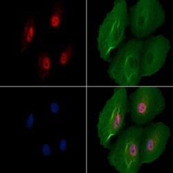 Invitrogen SNRNP70 Polyclonal Antibody 100 &mu;L; Unconjugated:Antibodies,