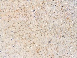 Invitrogen SNRNP70 Polyclonal Antibody 100 &mu;L; Unconjugated:Antibodies,