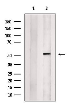Invitrogen SNRNP70 Polyclonal Antibody 100 &mu;L; Unconjugated:Antibodies,