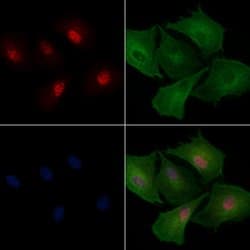 Invitrogen SNRPN Polyclonal Antibody 100 &mu;L; Unconjugated:Antibodies,