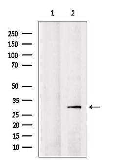 Invitrogen SNRPN Polyclonal Antibody 100 &mu;L; Unconjugated:Antibodies,