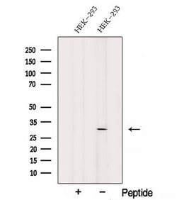 Invitrogen SNRPN Polyclonal Antibody 100 &mu;L; Unconjugated:Antibodies,