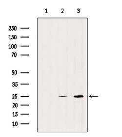 Invitrogen SNRPN Polyclonal Antibody 100 &mu;L; Unconjugated:Antibodies,