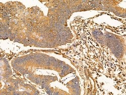 Invitrogen SNX6 Polyclonal Antibody 100 μL; Unconjugated:Antibodies,