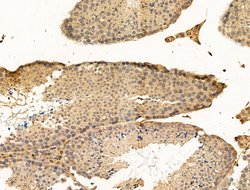 Invitrogen SNX6 Polyclonal Antibody 100 μL; Unconjugated:Antibodies,