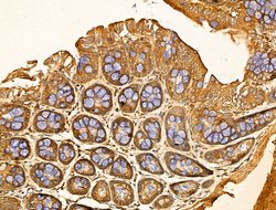 Invitrogen SNX6 Polyclonal Antibody 100 μL; Unconjugated:Antibodies,
