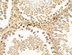 Invitrogen SNX6 Polyclonal Antibody 100 μL; Unconjugated:Antibodies,