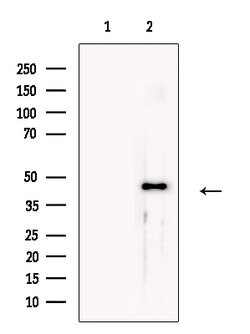 Invitrogen SNX6 Polyclonal Antibody 100 μL; Unconjugated:Antibodies,