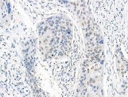 Invitrogen SON Polyclonal Antibody 100 &mu;L; Unconjugated:Antibodies,
